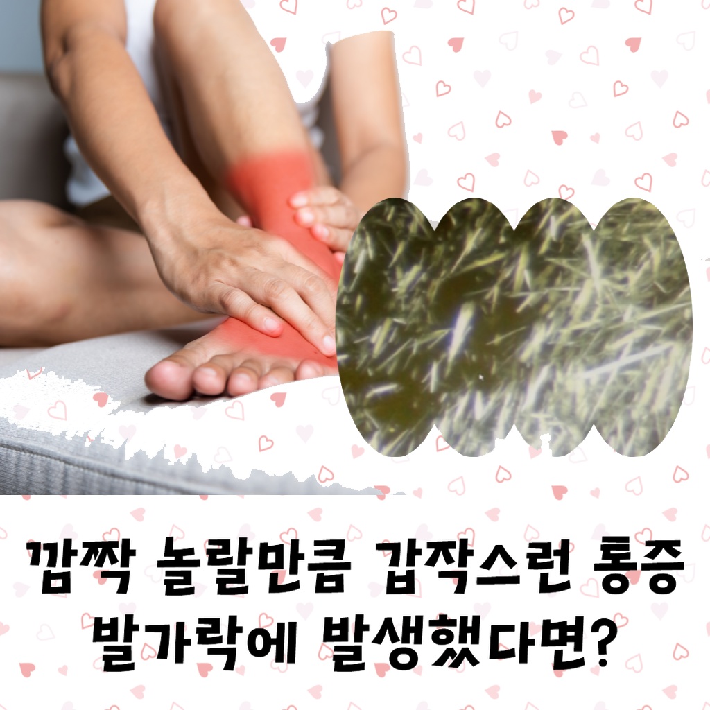 깜짝 놀랄 만큼 갑작스러운 통증이 발가락에 발생하는 통풍 설명 이미지