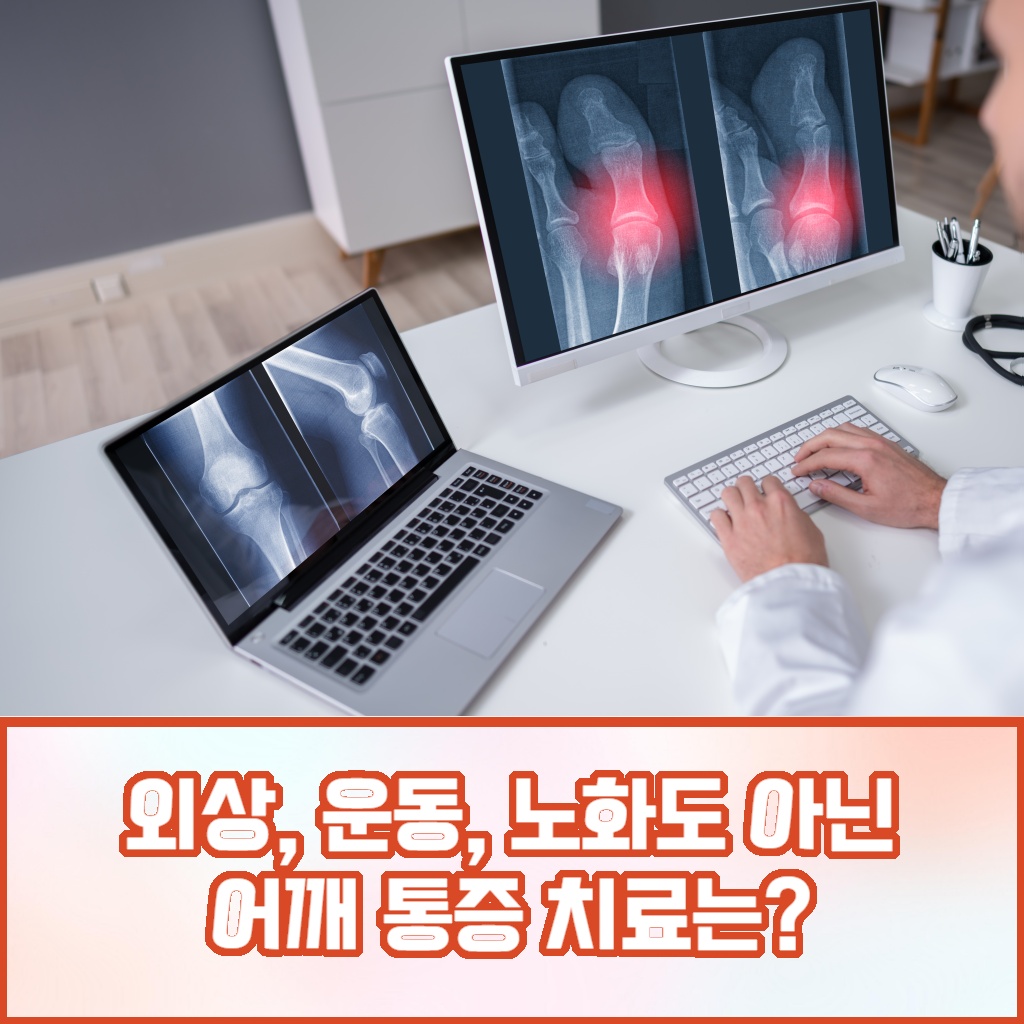 외상이나 운동, 노화가 아닌 원인으로 발생하는 어깨 통증 치료 방법 설명 이미지