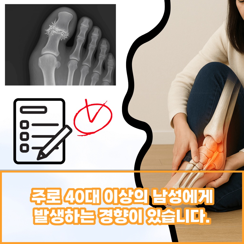 40대 이상 남성에게서 주로 발생하는 질환 설명 이미지