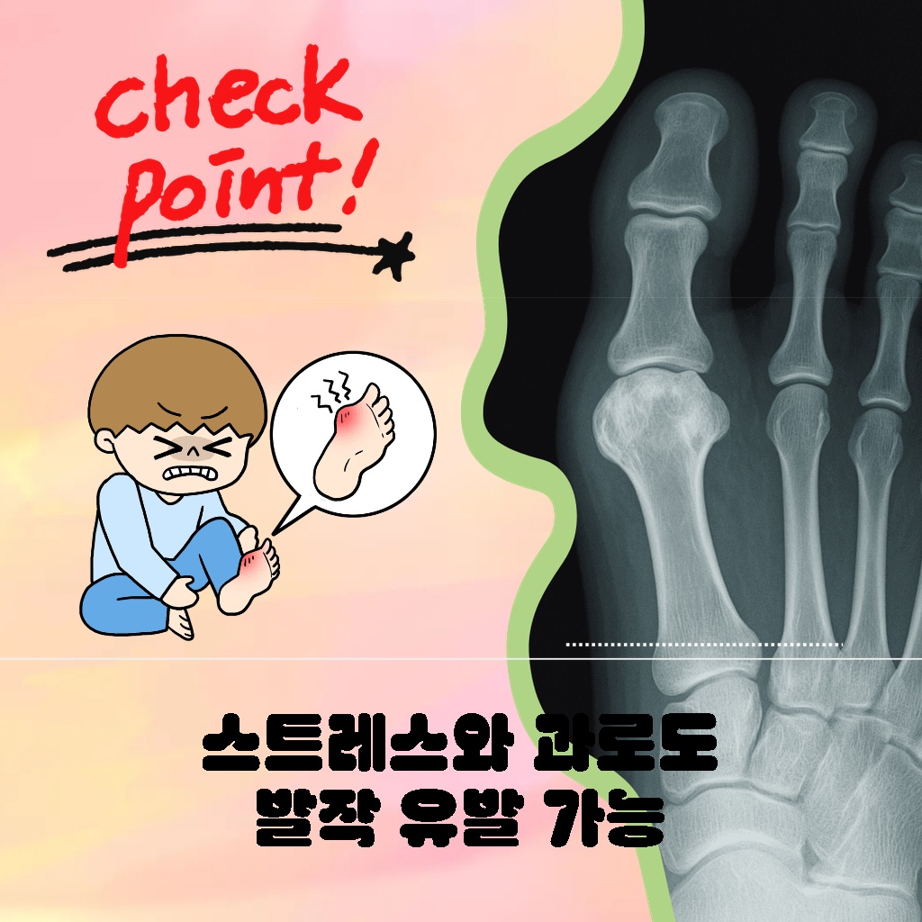 스트레스와 과로로도 발작이 유발될 수 있다는 설명 이미지