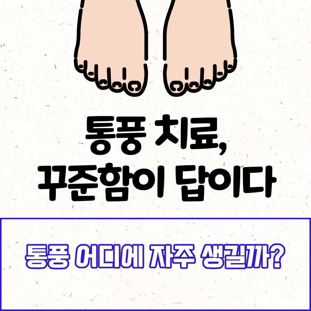 통풍이 자주 생기는 부위 설명 이미지