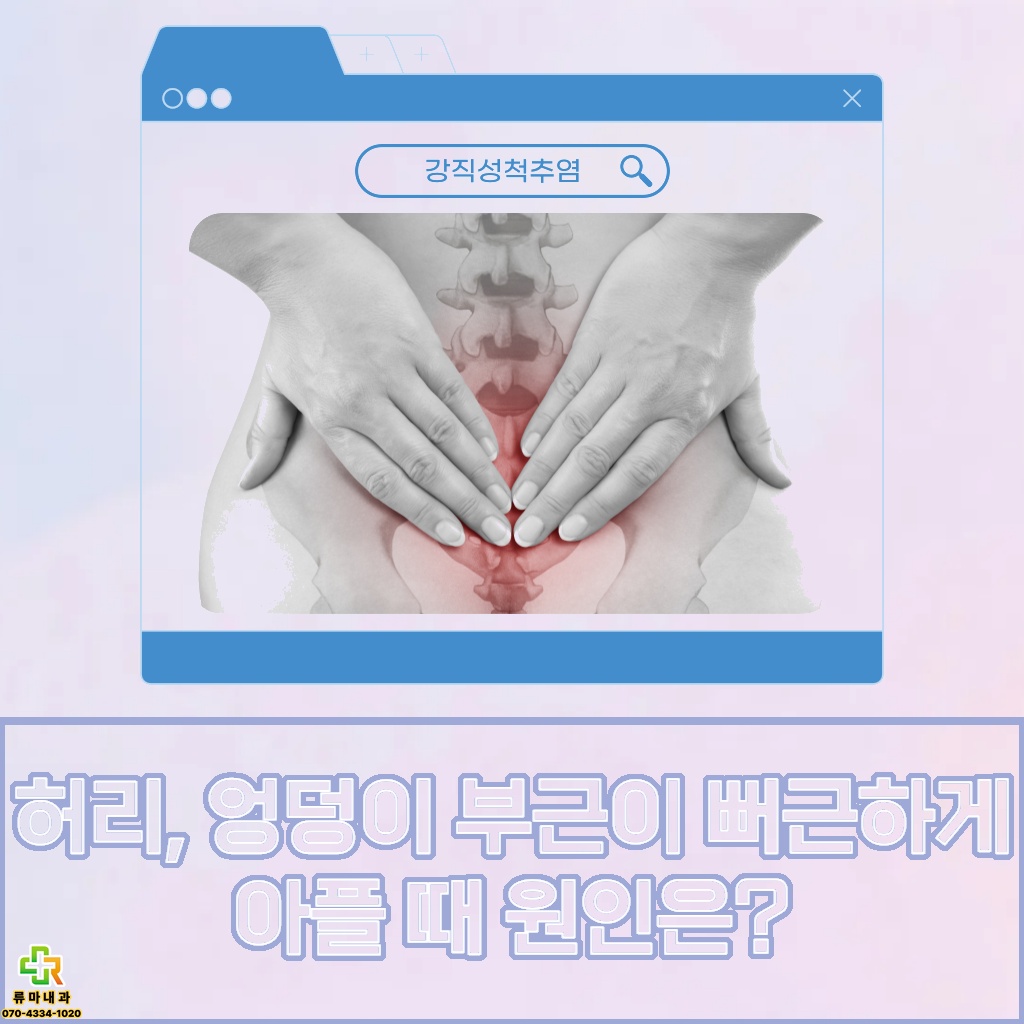 허리와 엉덩이 부근이 뻐근하게 아픈 원인 설명 이미지