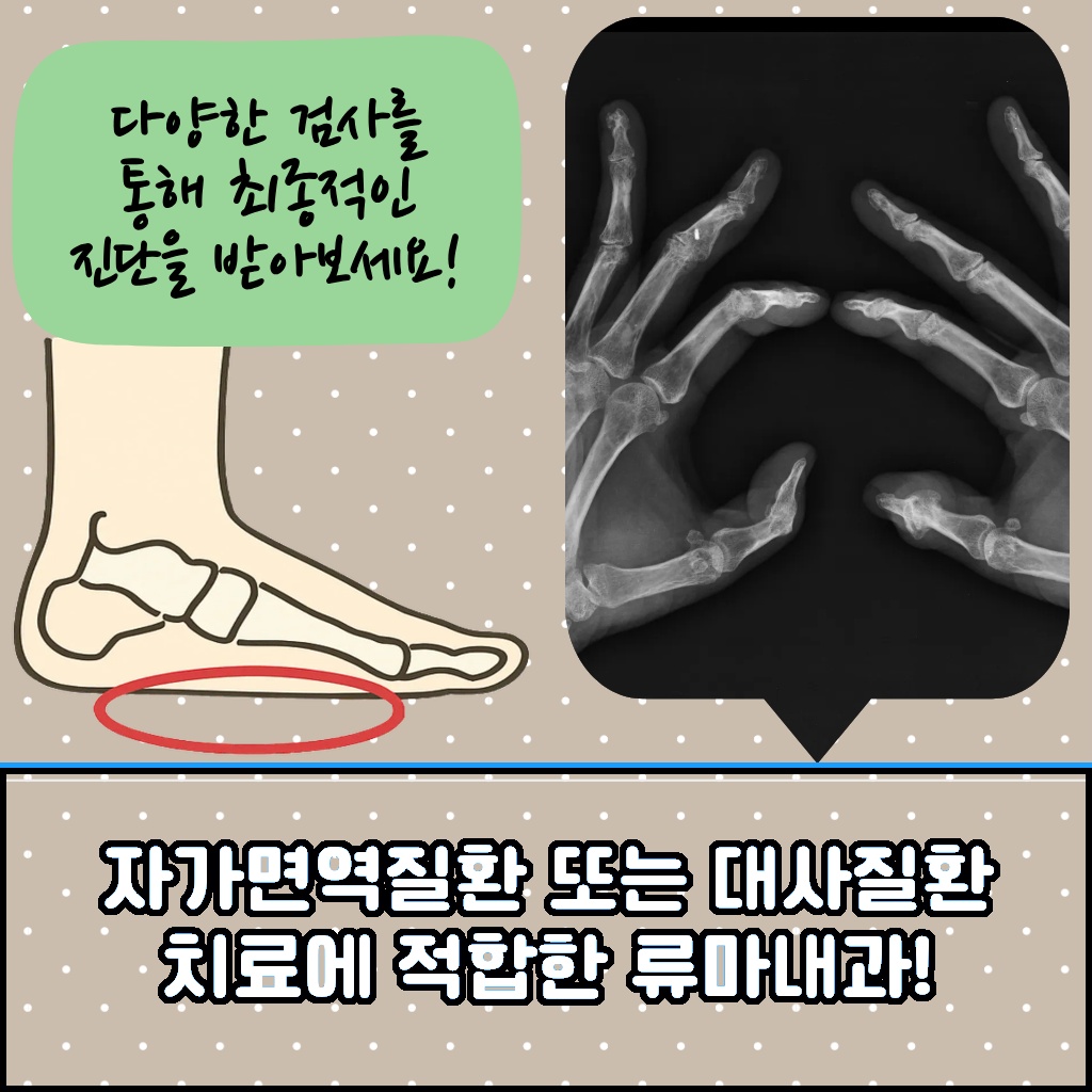 자가면역질환 및 대사질환 치료에 적합한 류마내과 설명 이미지