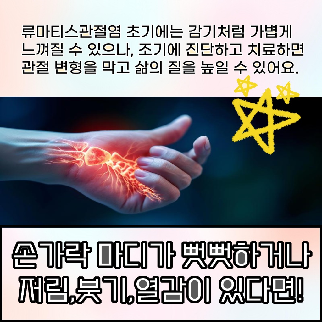 손가락 마디의 뻣뻣함과 저림, 붓기, 열감 증상이 나타나는 류마티스관절염 초기 증상 설명 이미지