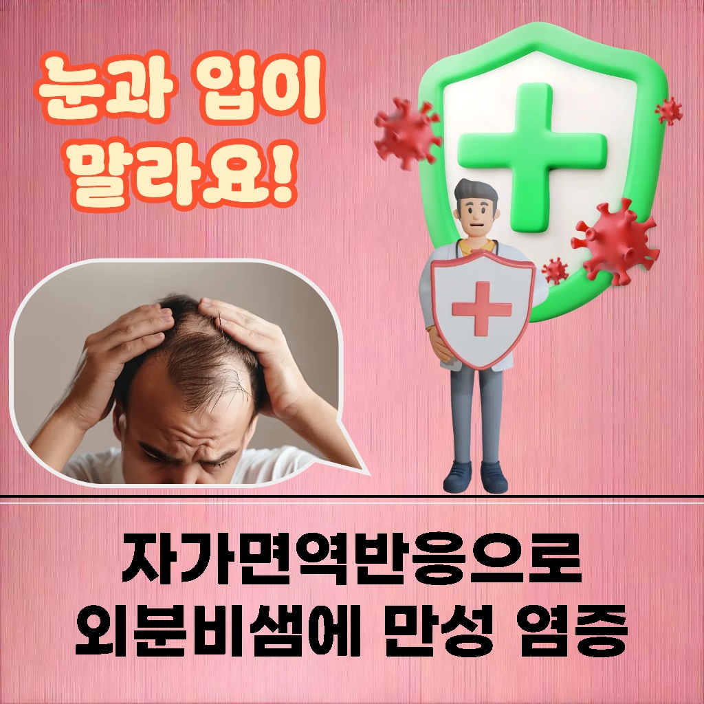 자가면역반응으로 인해 외분비샘에 만성 염증이 생겨 눈과 입이 마르는 증상 설명 이미지