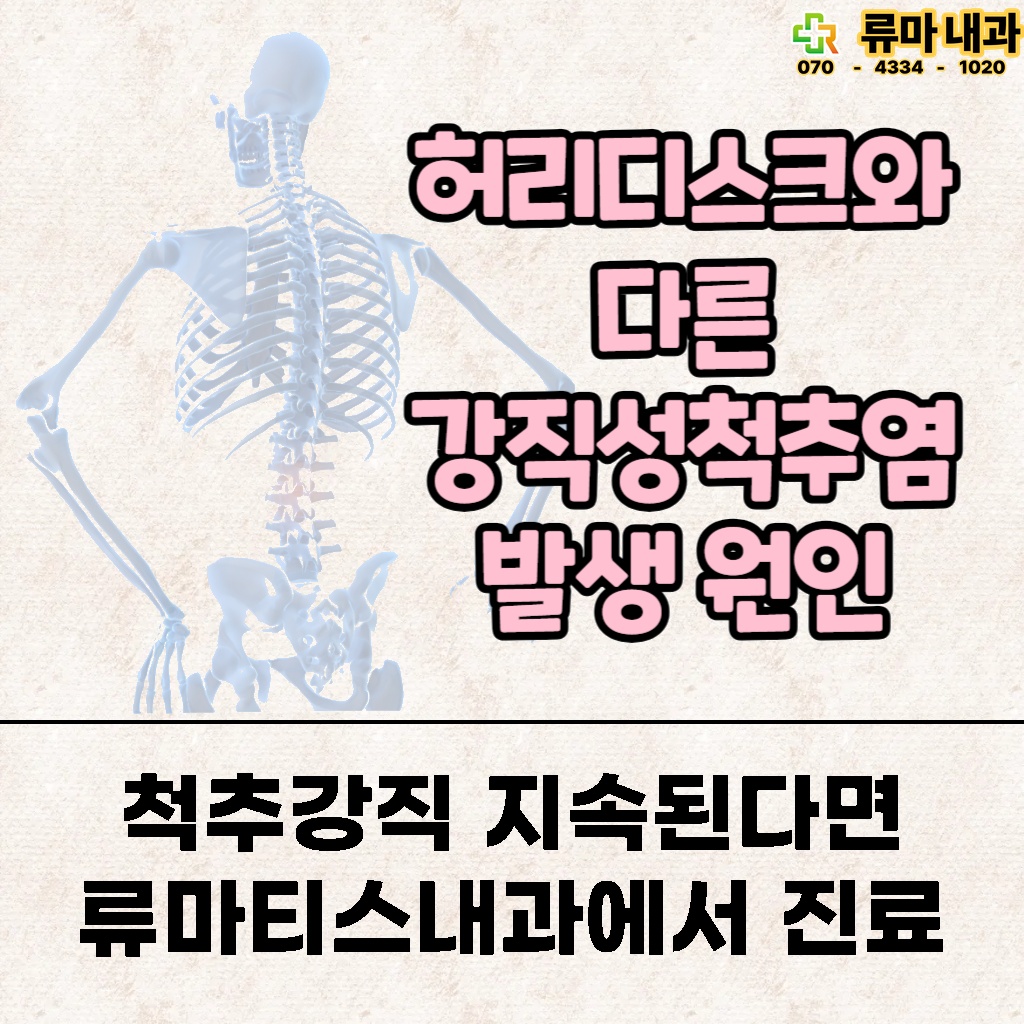 척추강직이 지속된다면 류마티스내과에서 진료받아야 한다는 설명 이미지