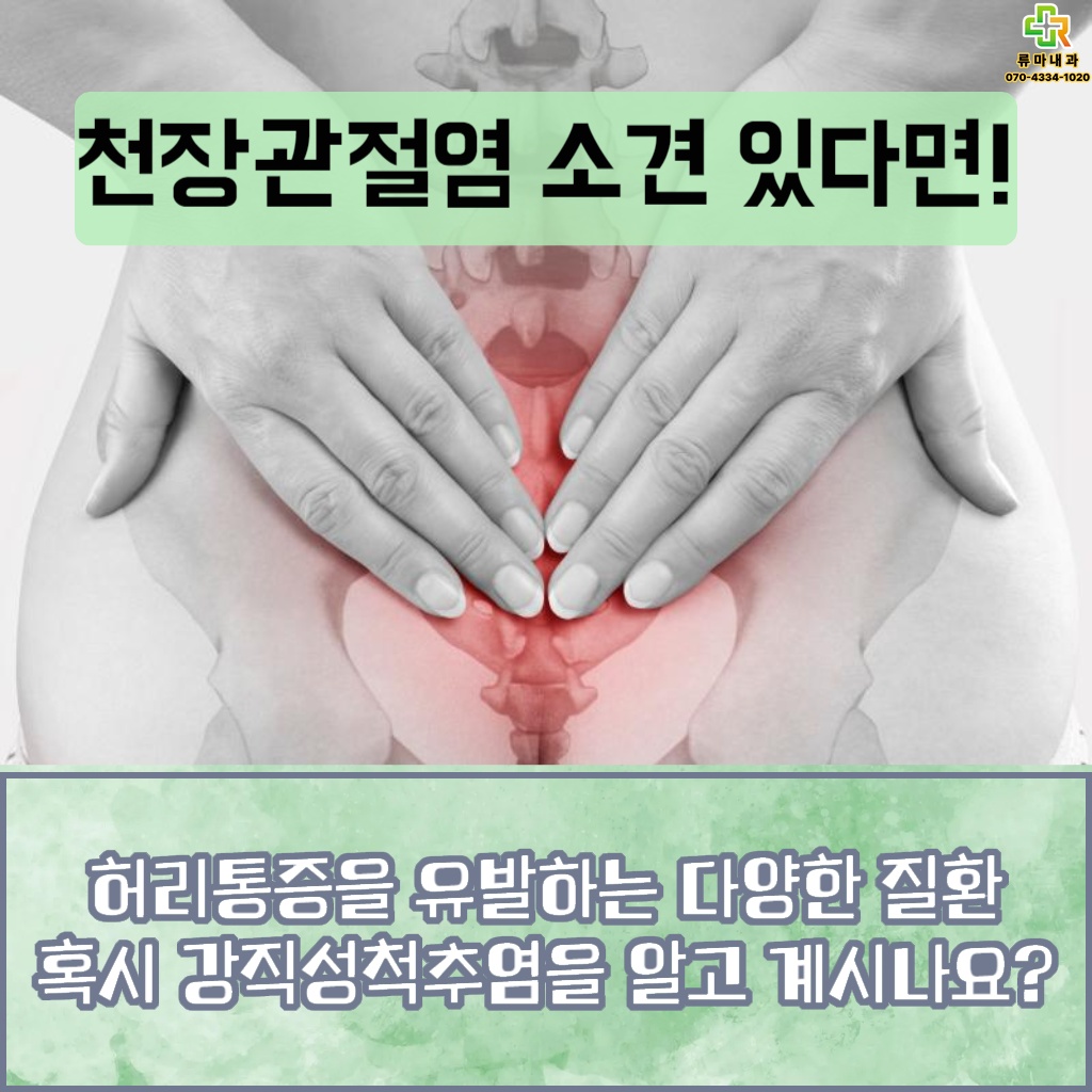 허리통증을 유발하는 질환인 강직성척추염 설명 이미지