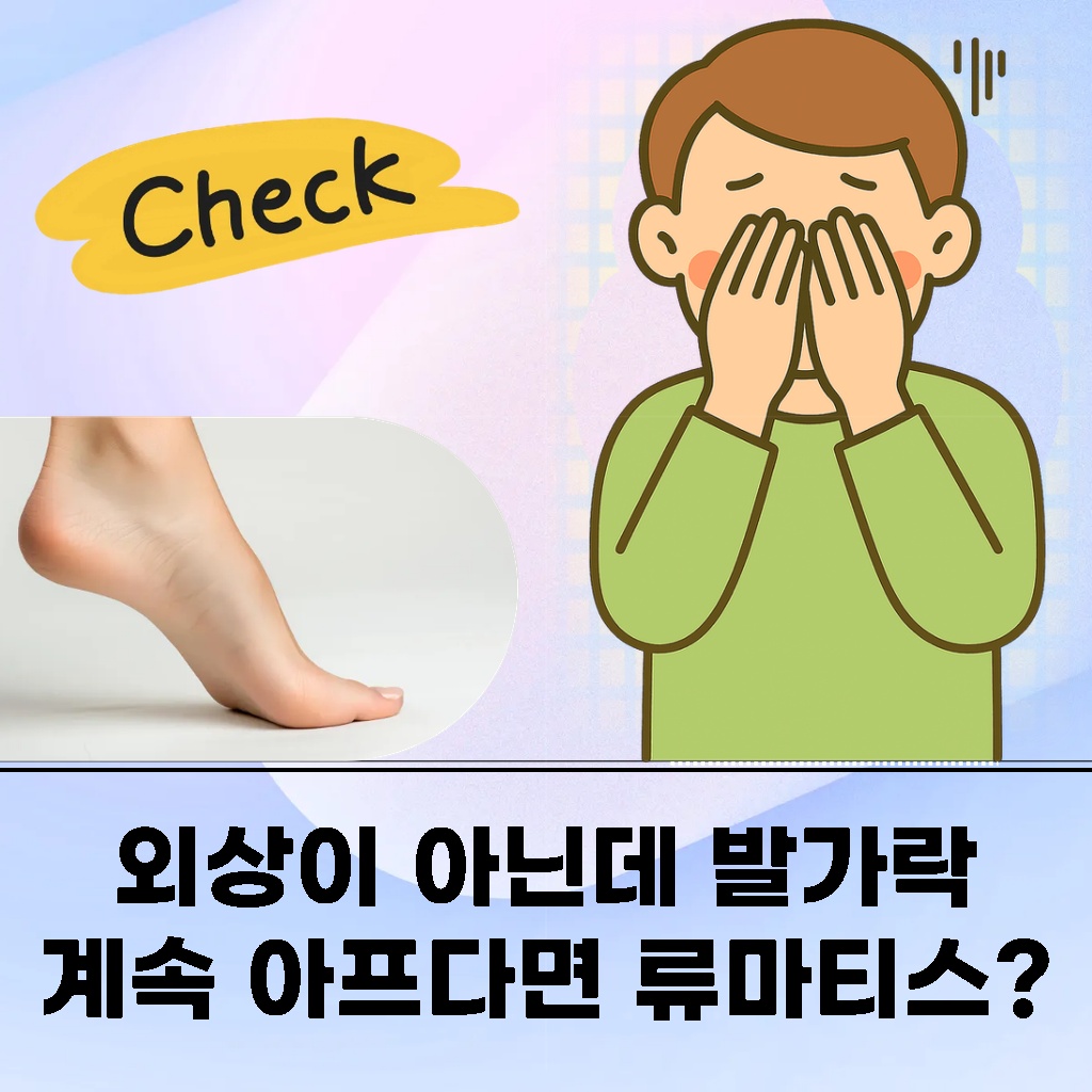 외상이 없는데도 발가락이 계속 아플 때 의심되는 류마티스 설명 이미지