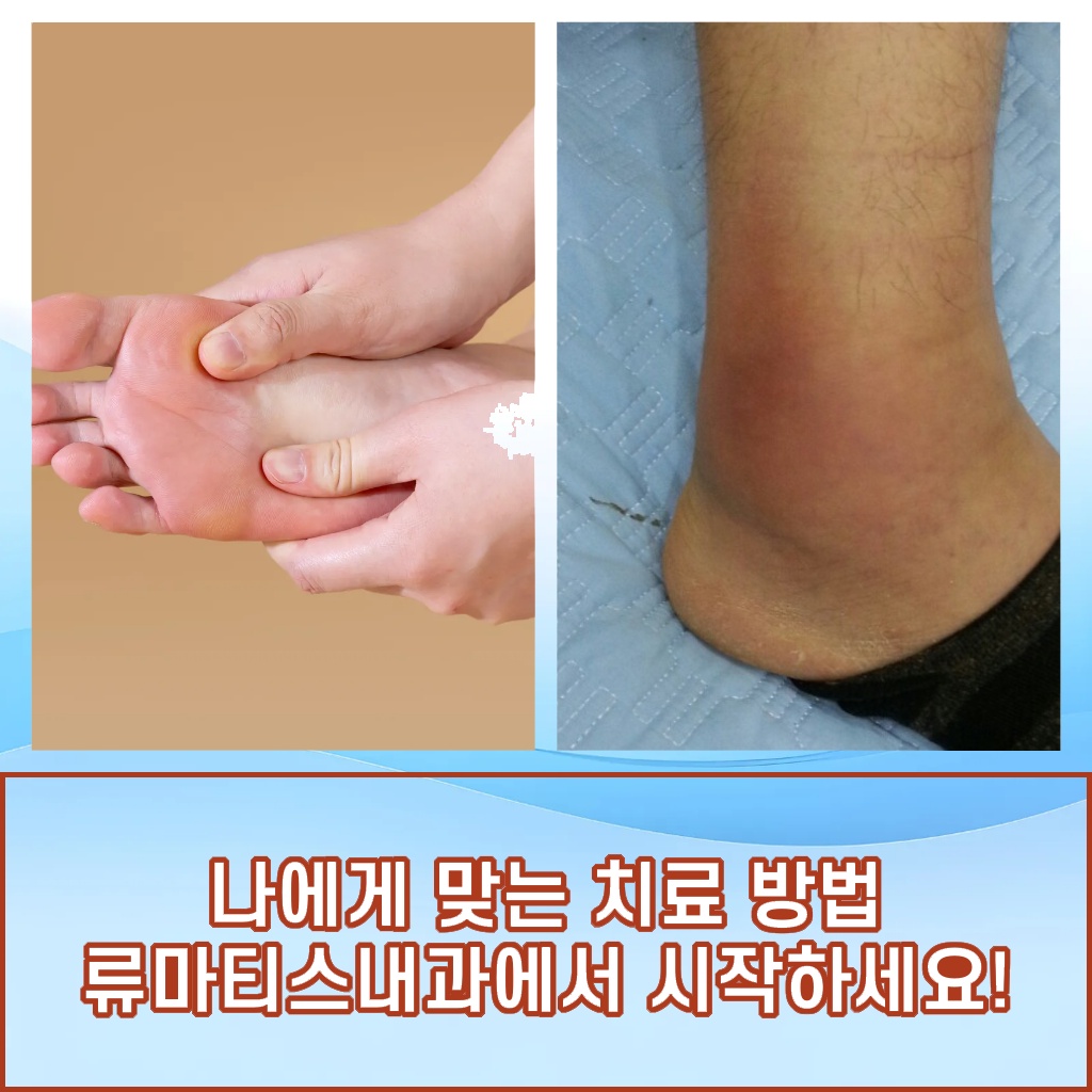 나에게 맞는 치료 방법을 류마티스내과에서 시작하라는 설명 이미지