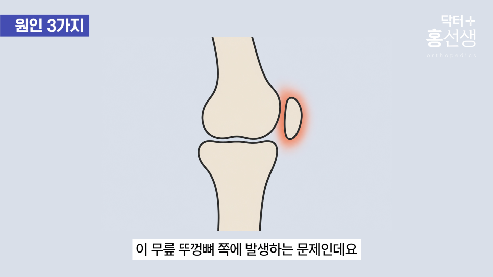 9e5921d93a215.png
