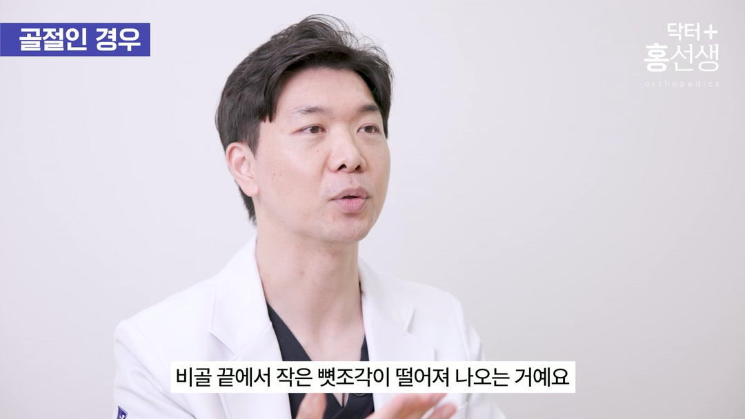 비골 끝에서 뼈 조각이 떨어지는 사진