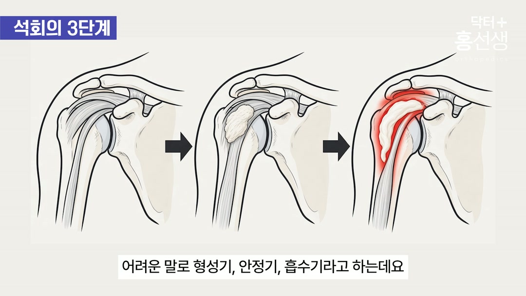 형성기·안정기·흡수기 세 단계 명칭 제시