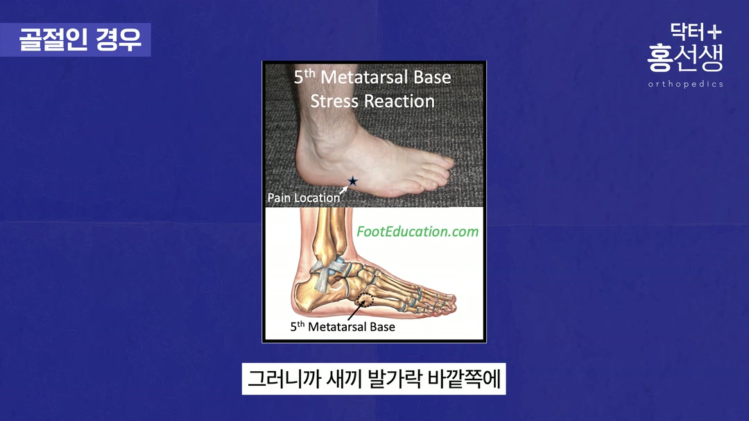 초기 관리 실패 시 결과 설명