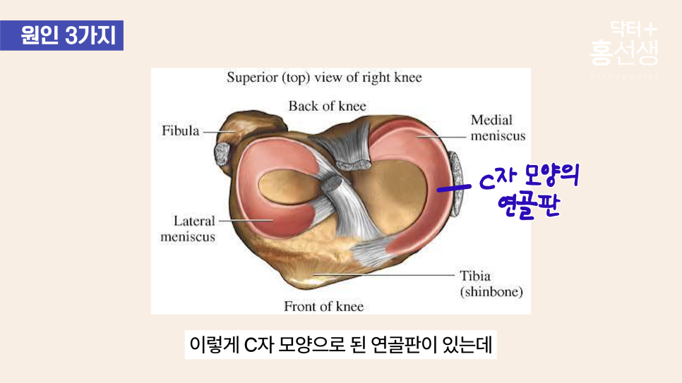 fa7b92004eaea.png