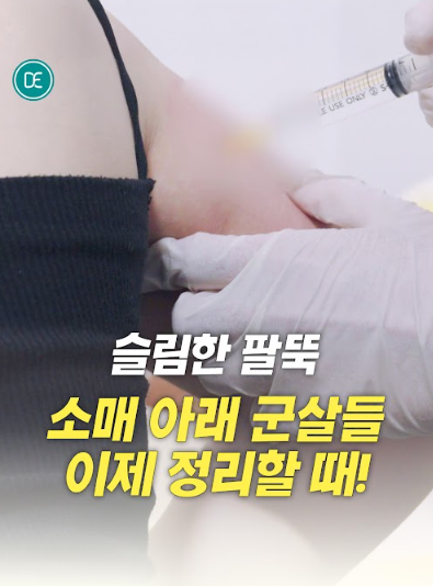 GPC 바디지방분해주사 구로피부과 닥터에버스