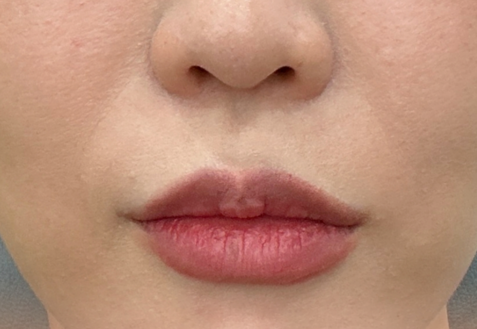 케이스 J 전 사진