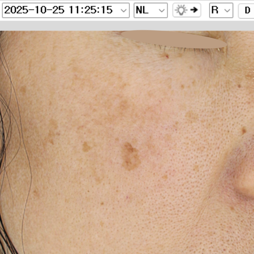 케이스 N 전 사진