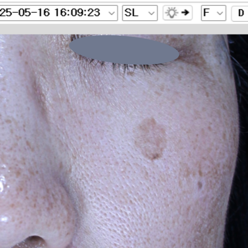 케이스 M 전 사진