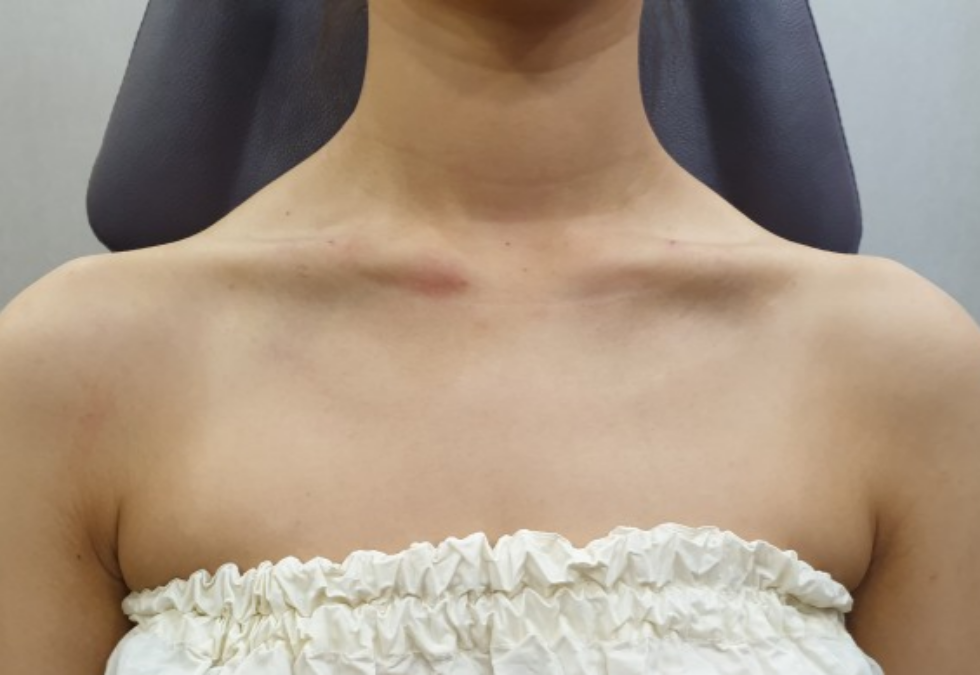 케이스 k후 사진