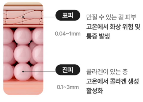 올타이트 피부층별 작용 설명 - 표피·진피·SMAS층 구조도