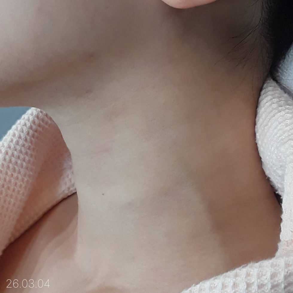 케이스 p후 사진