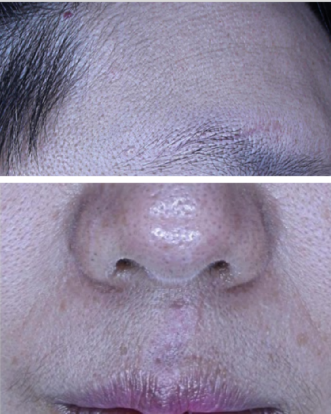 케이스 G후 사진