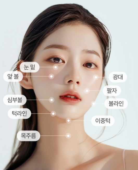 올타이트 시술 가능 부위 - 얼굴 전체 리프팅 부위 안내도