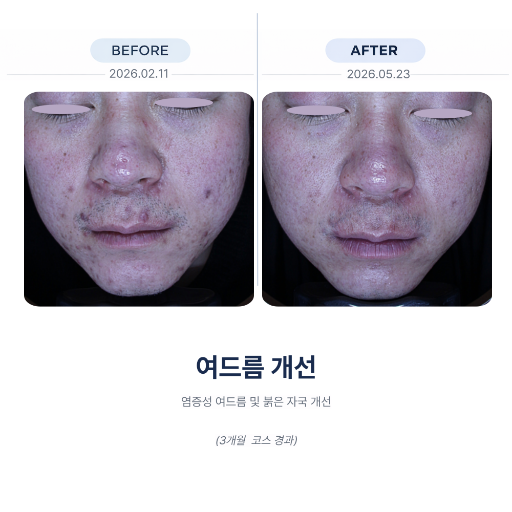 전후사진