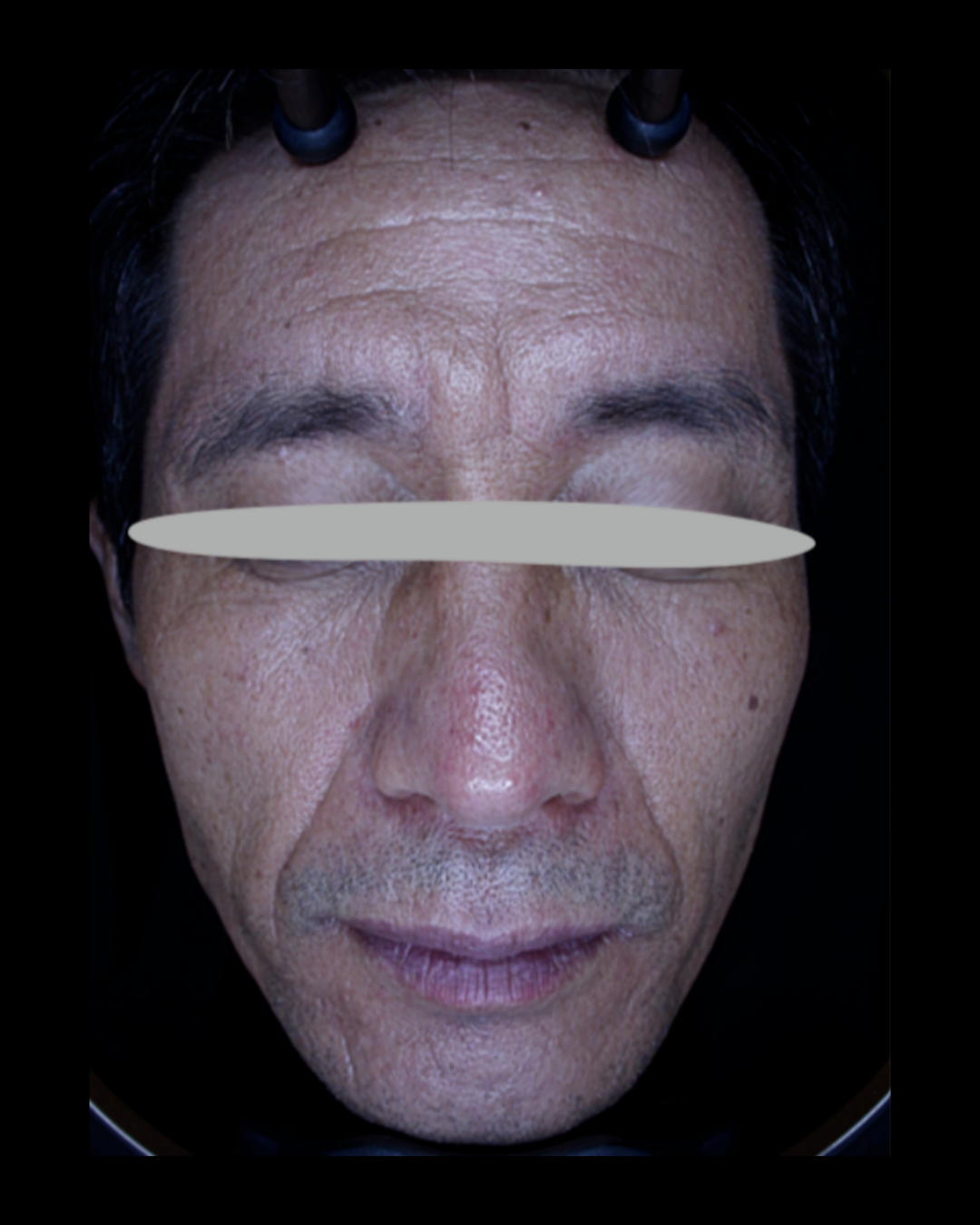 케이스 A 전 사진