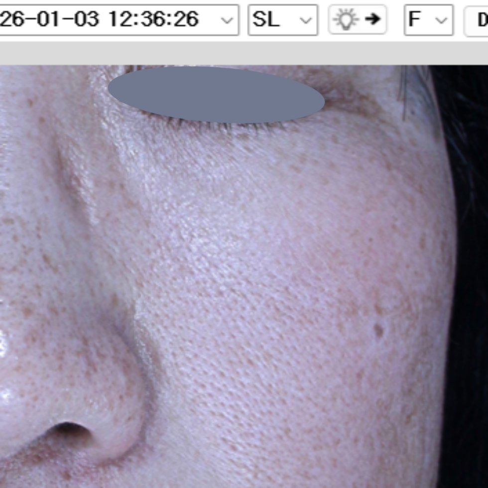 케이스 M후 사진