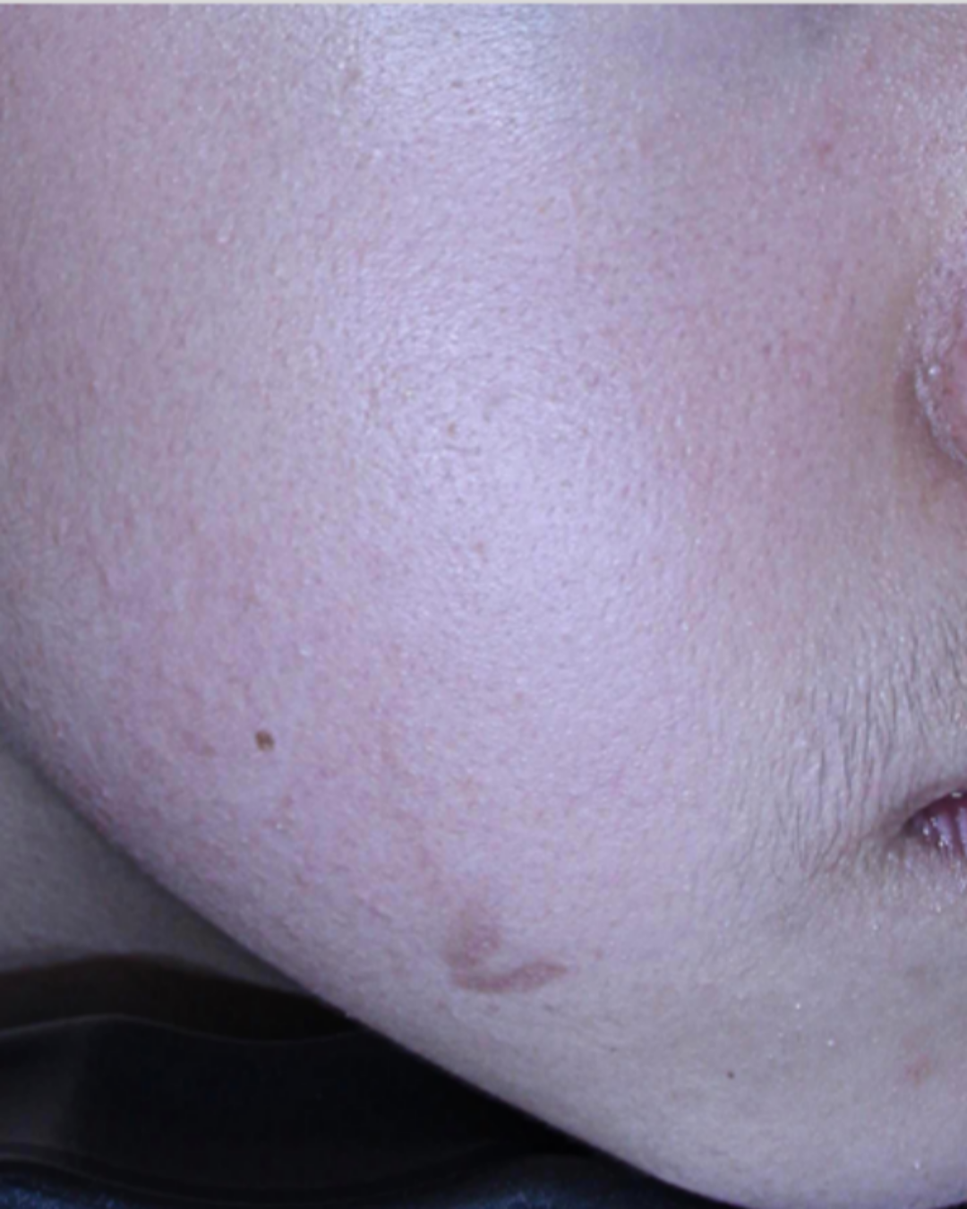 케이스 F 전 사진