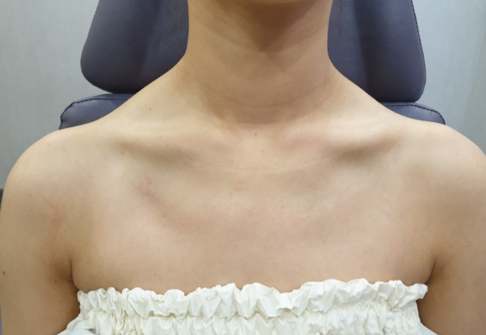 케이스 k 전 사진