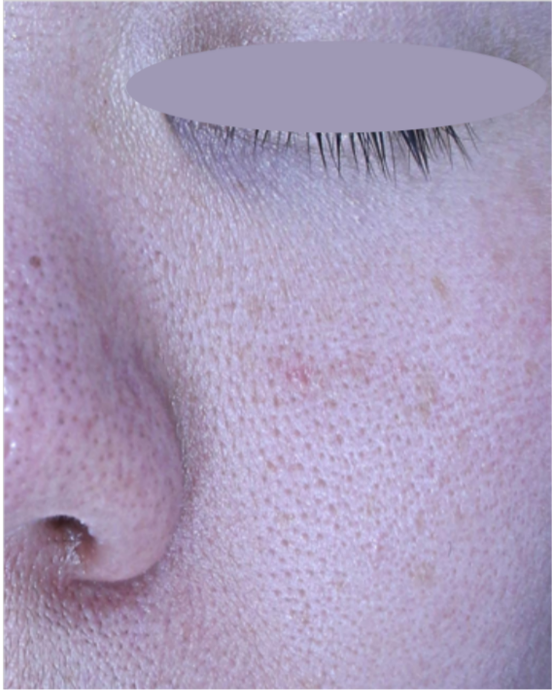 케이스 D후 사진