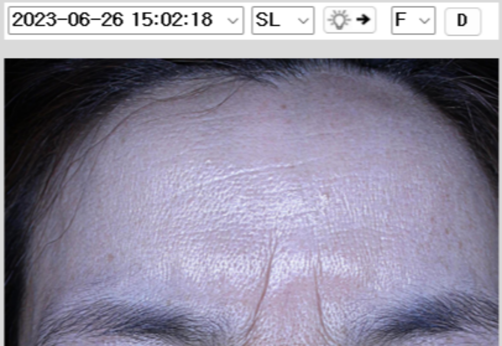 케이스 h 전 사진