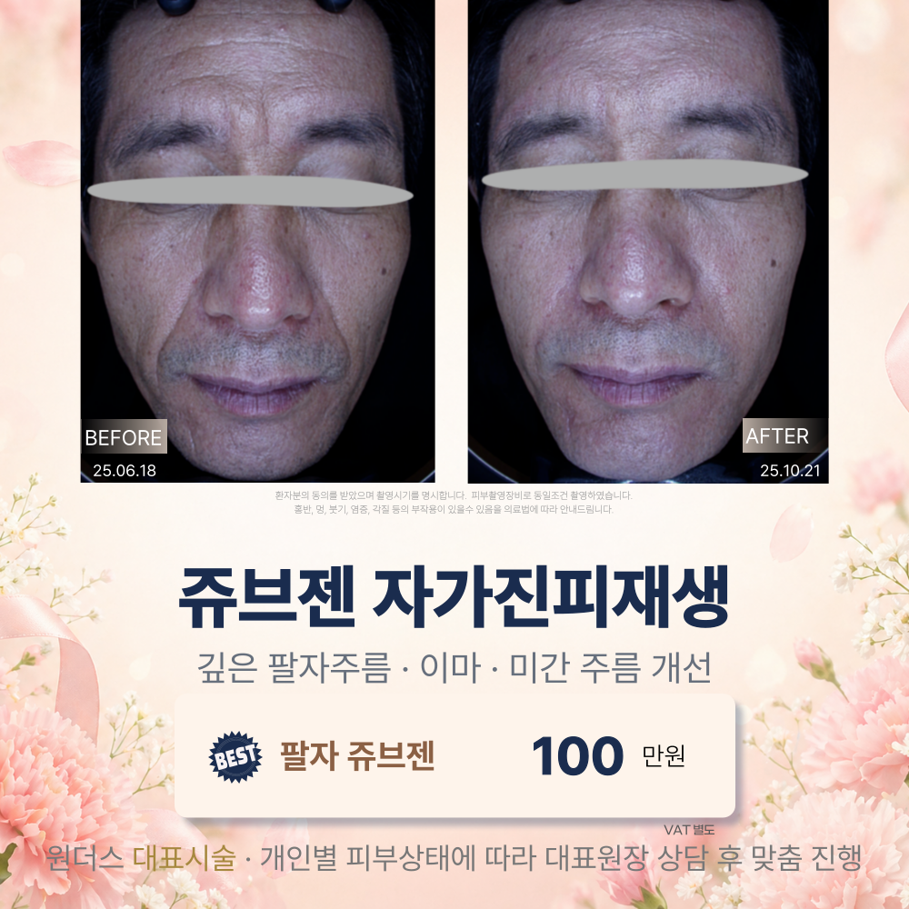 쥬브젠 이벤트가격