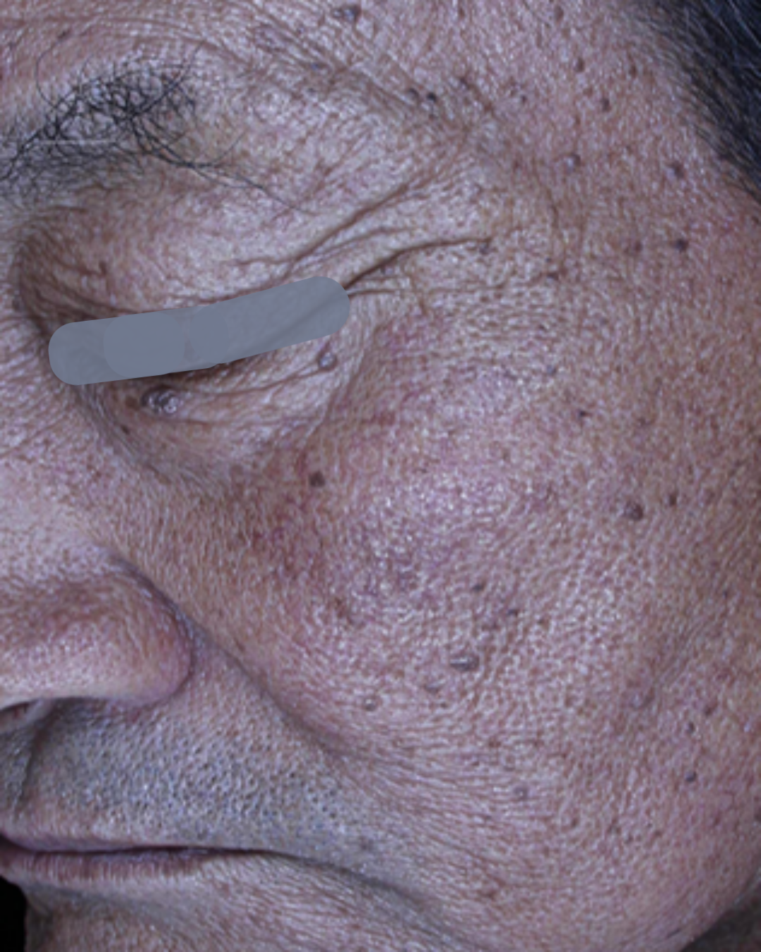 케이스 C 전 사진