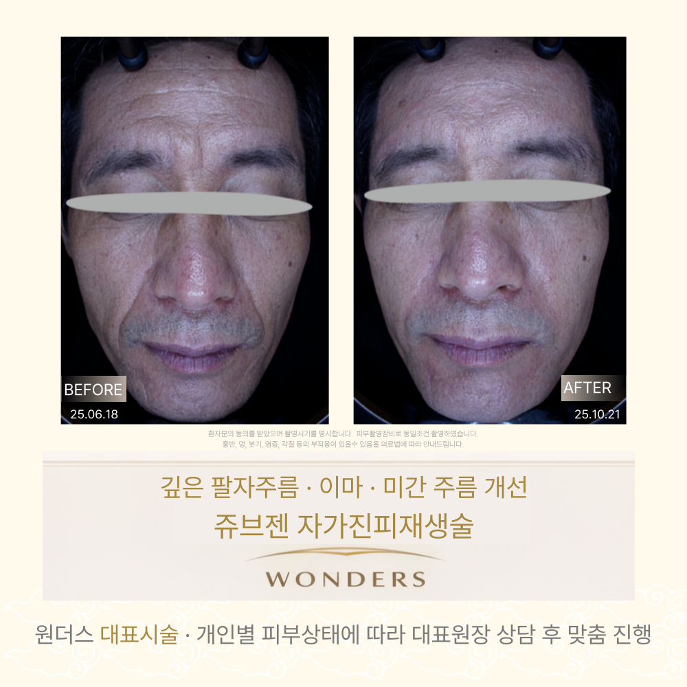 원더스 4월 이벤트 대표 이미지쥬브젠전