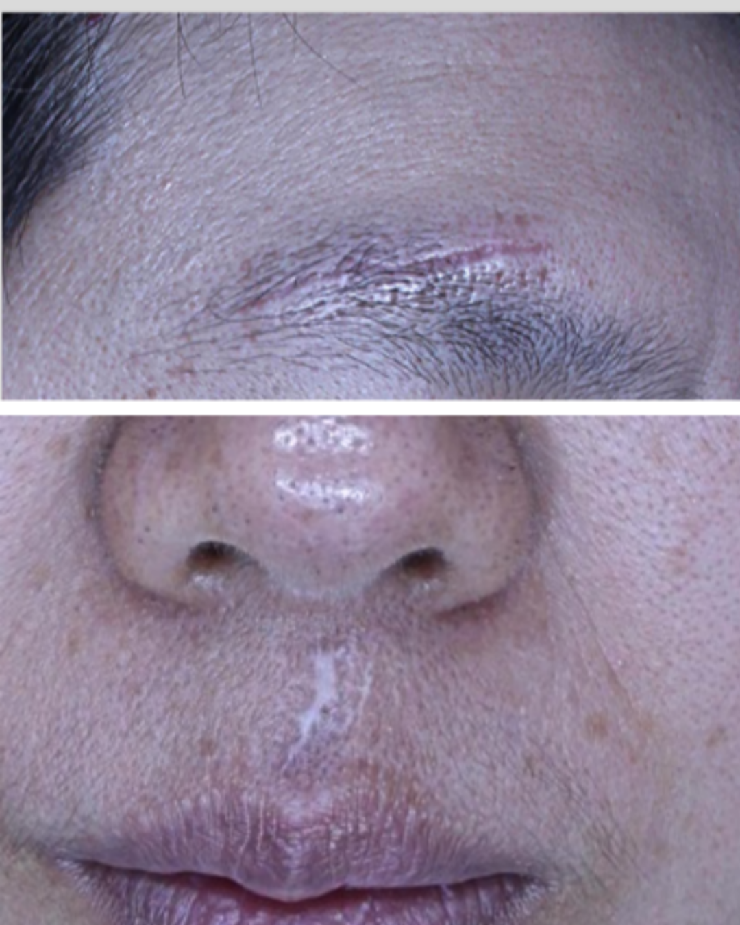 케이스 G 전 사진