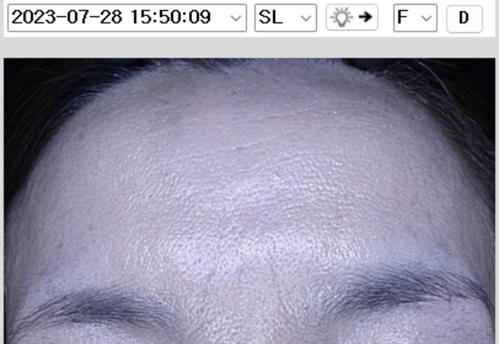 케이스 h후 사진