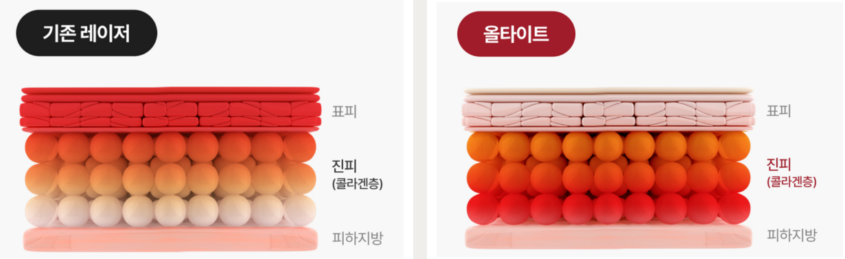올타이트 HIF-RF 에너지 전달 원리 - 기존 고주파 대비 깊은 층까지 균일한 에너지 도달 설명
