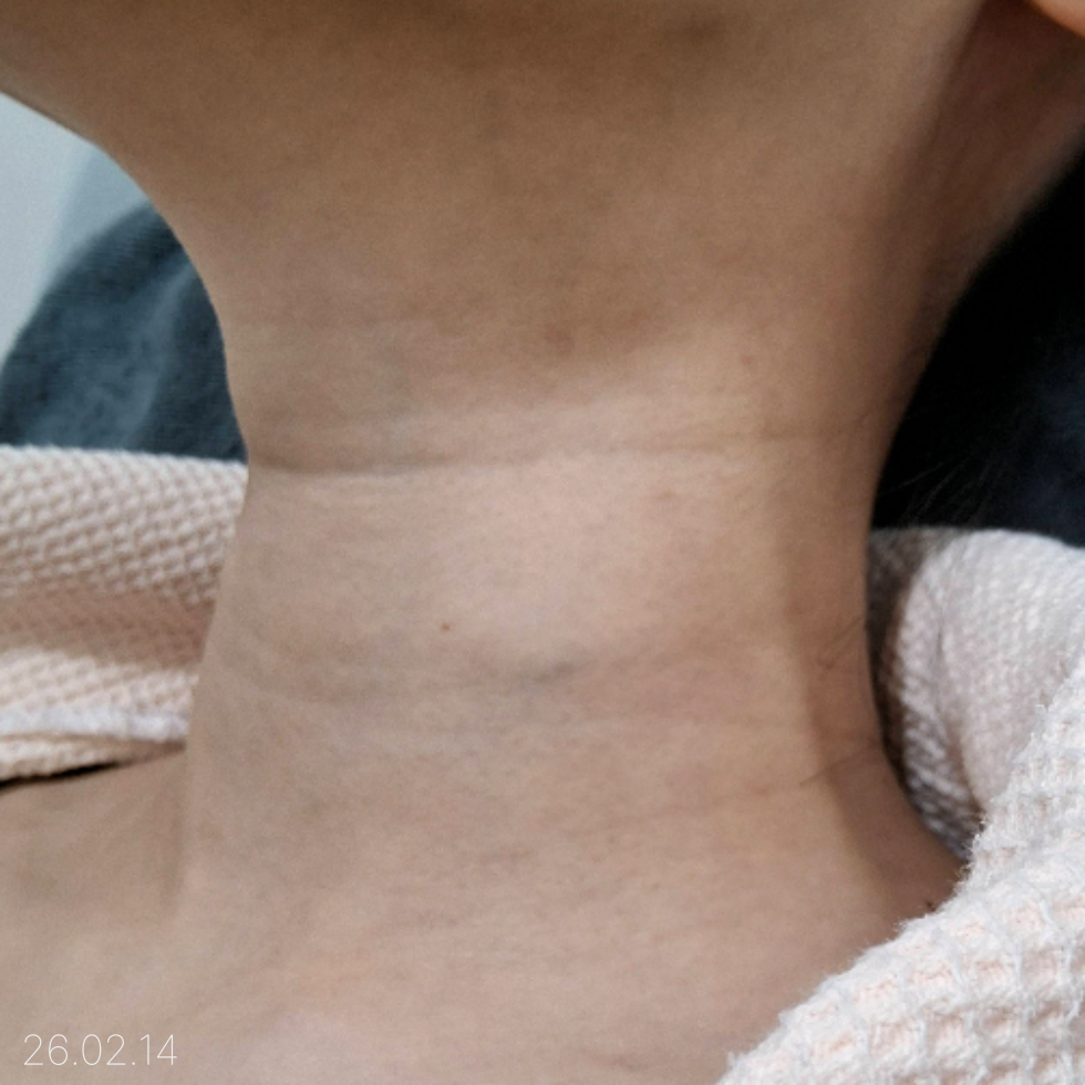 케이스 p 전 사진