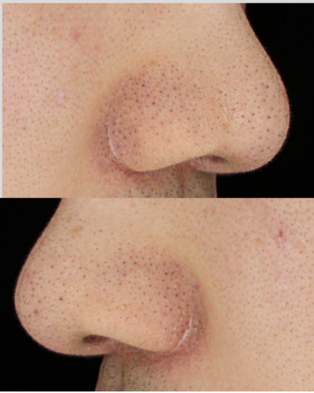 케이스 E전 사진