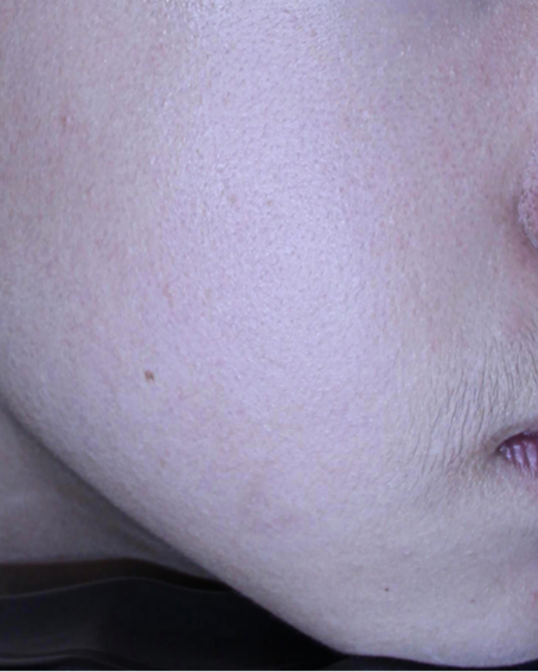 케이스 F후 사진