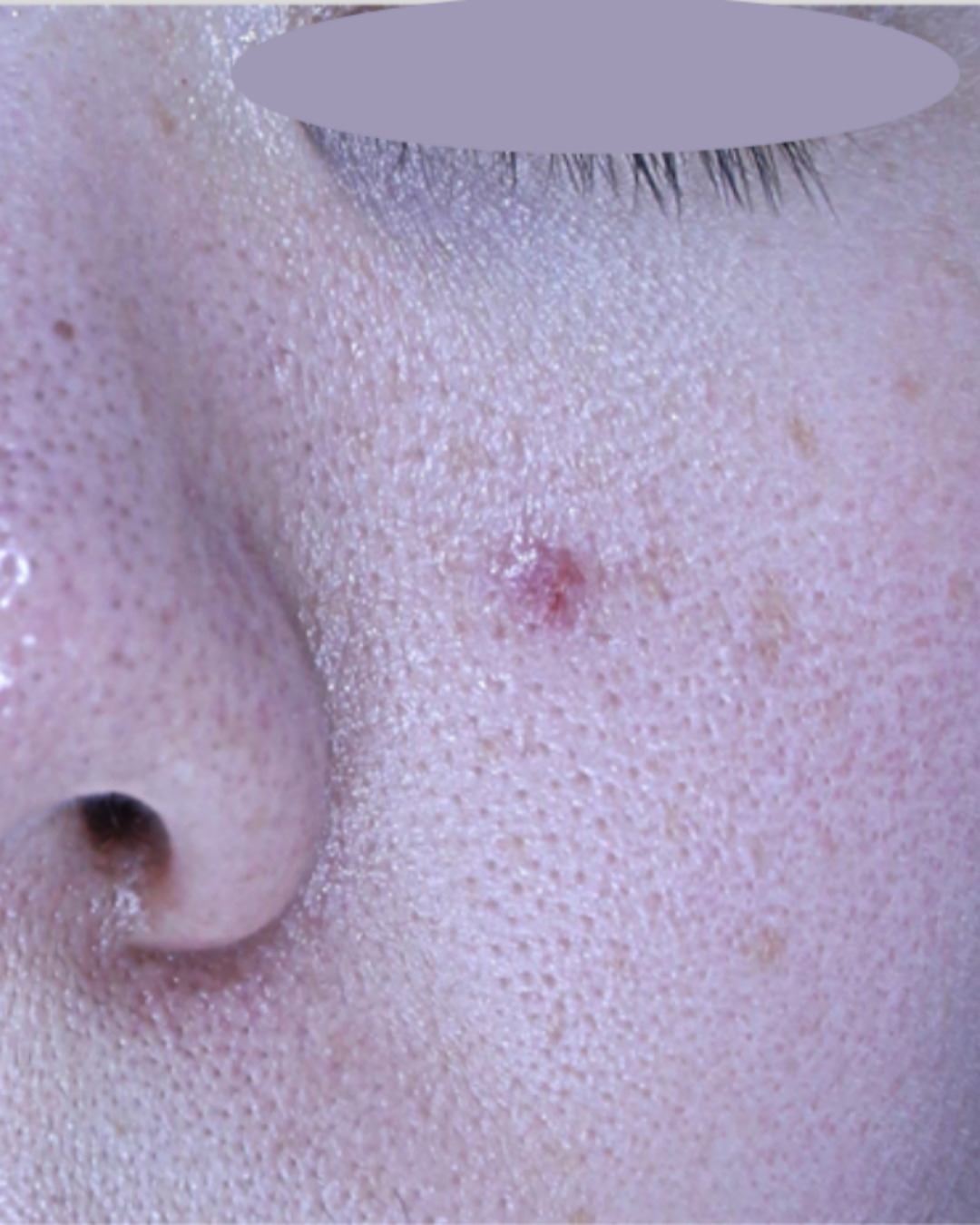 케이스 D 전 사진