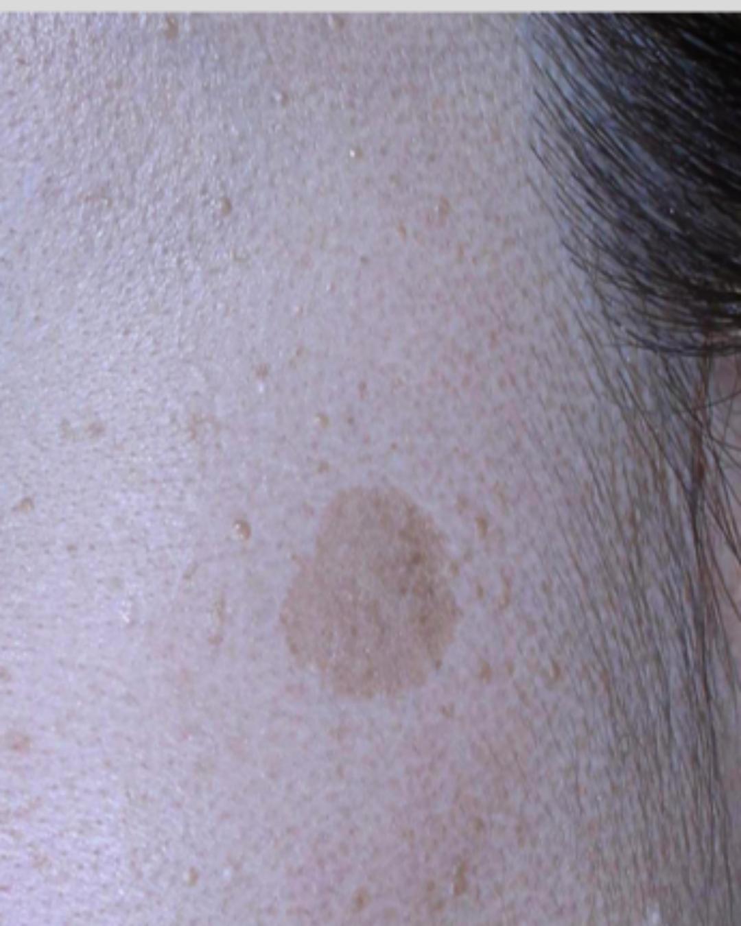 케이스 B 전 사진