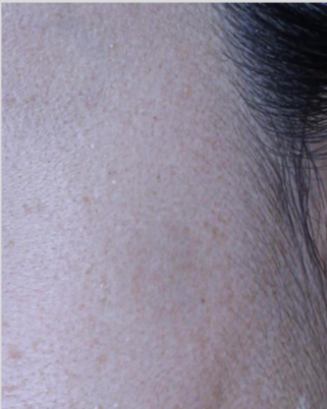 케이스 B 후 사진