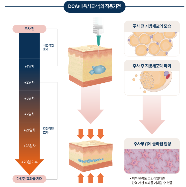DCA 디옥시콜산 지방세포 파괴 작용 기전 3단계 - 주입·파괴·배출 원리 도식