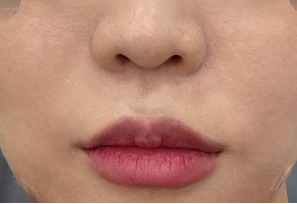 케이스 J후 사진