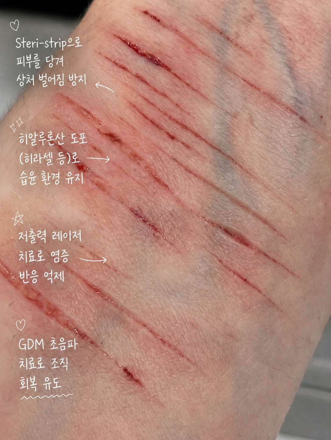 caca141f589c5.png