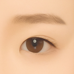 Before medial epicanthoplasty